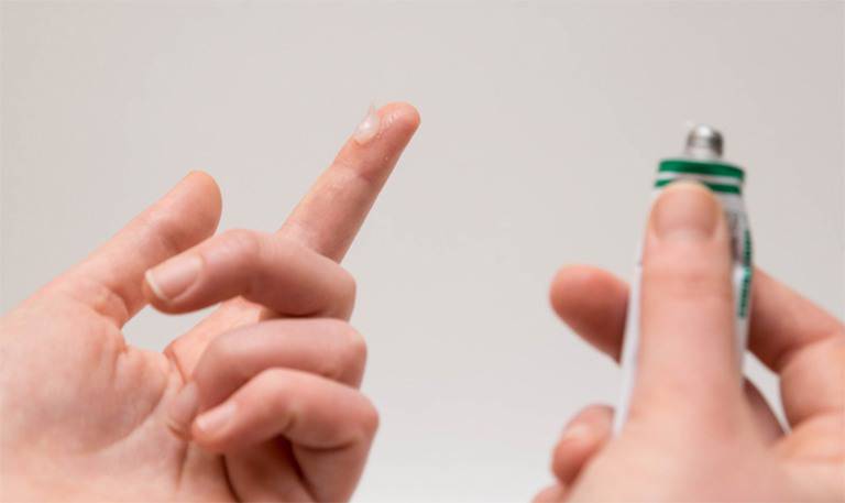  Thuốc mỡ bôi cho vùng da đầu bị vảy nến