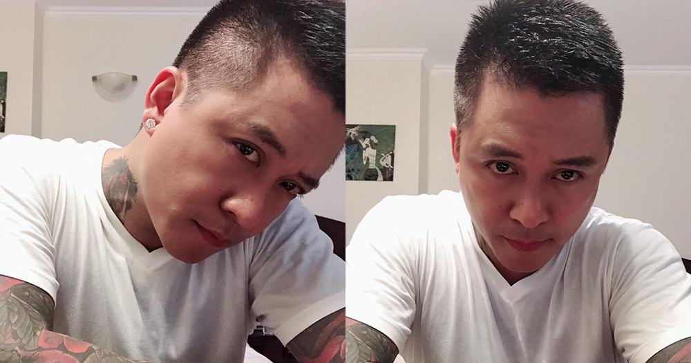 Tuấn Hưng chia sẻ hình ảnh sau một tuần điều trị vảy nến